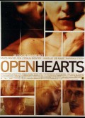 OPEN HEARTS